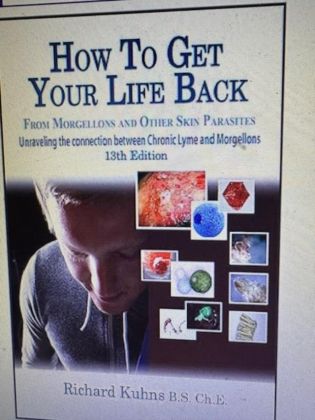 How To Get Your Life Back from Morgellons and Other Skin Parasites 