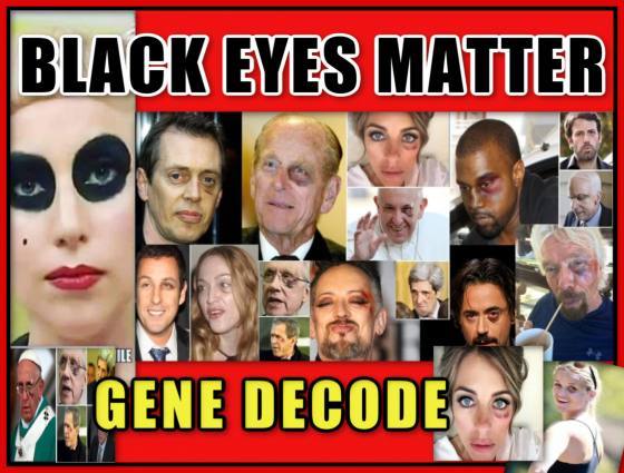 SpirituallyRAW Ep 385 GENE DECODE on BLACK EYES MATTER! PANDA EYES Another Satanic Child Abuse Mystery Uncovered and Hollywood Gender Inversions 